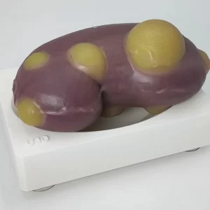 Partial nephrectomy training kit